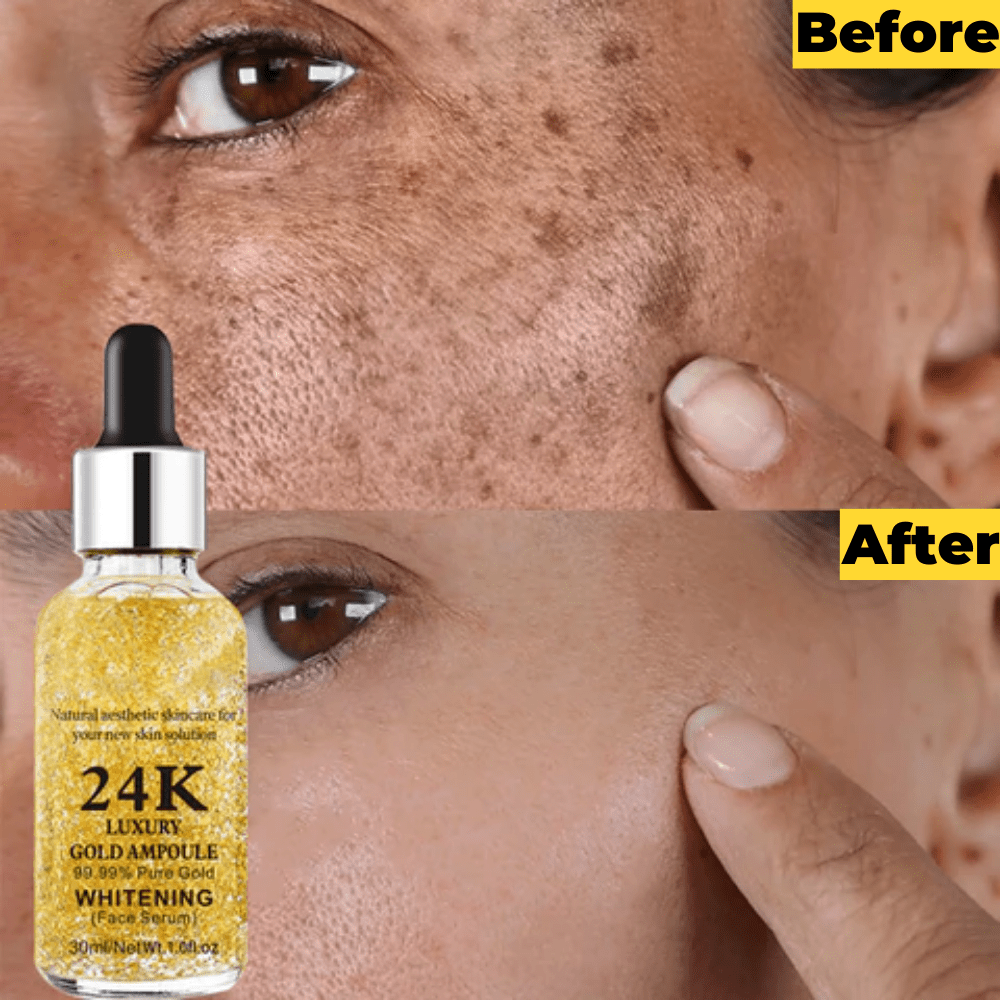 Rejuviox™️ 24K Gold Serum (Pack of 2)