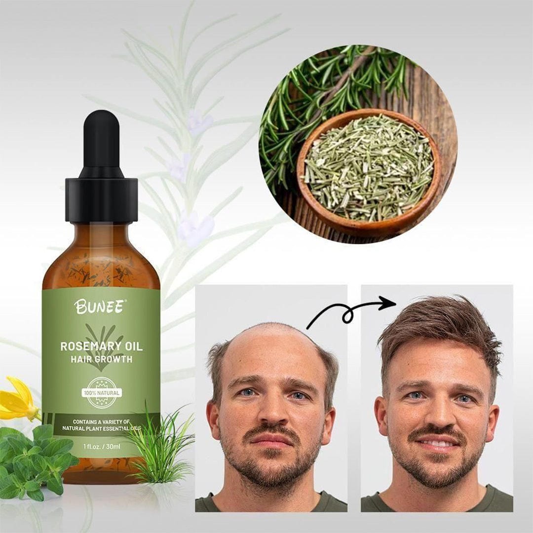 GrowGleam™️ Rosemary Hair Growth Serum Oil Zaavio®