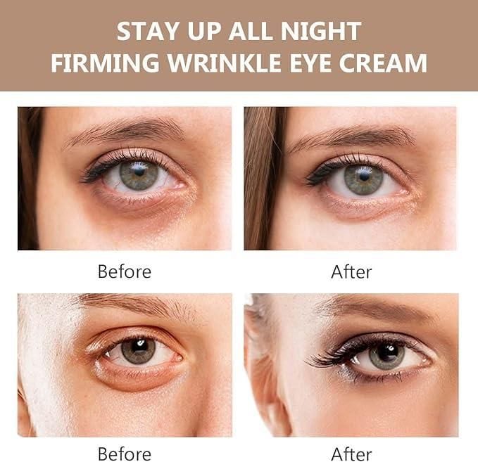 ORIGINAL™ Instant Firmx Eye Bag Cream