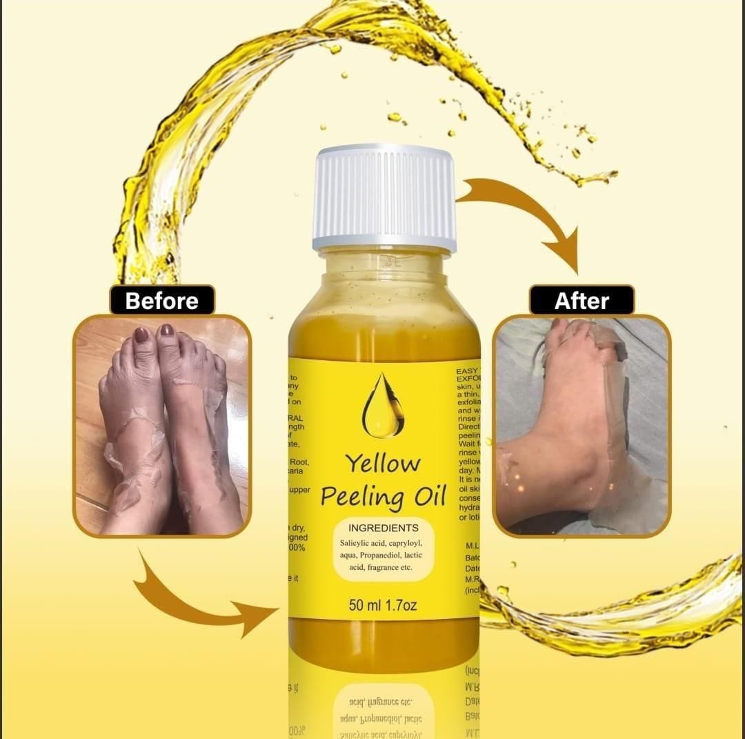 RadiateResplend™️ Peeling Oil for Skin (Pack of 2)