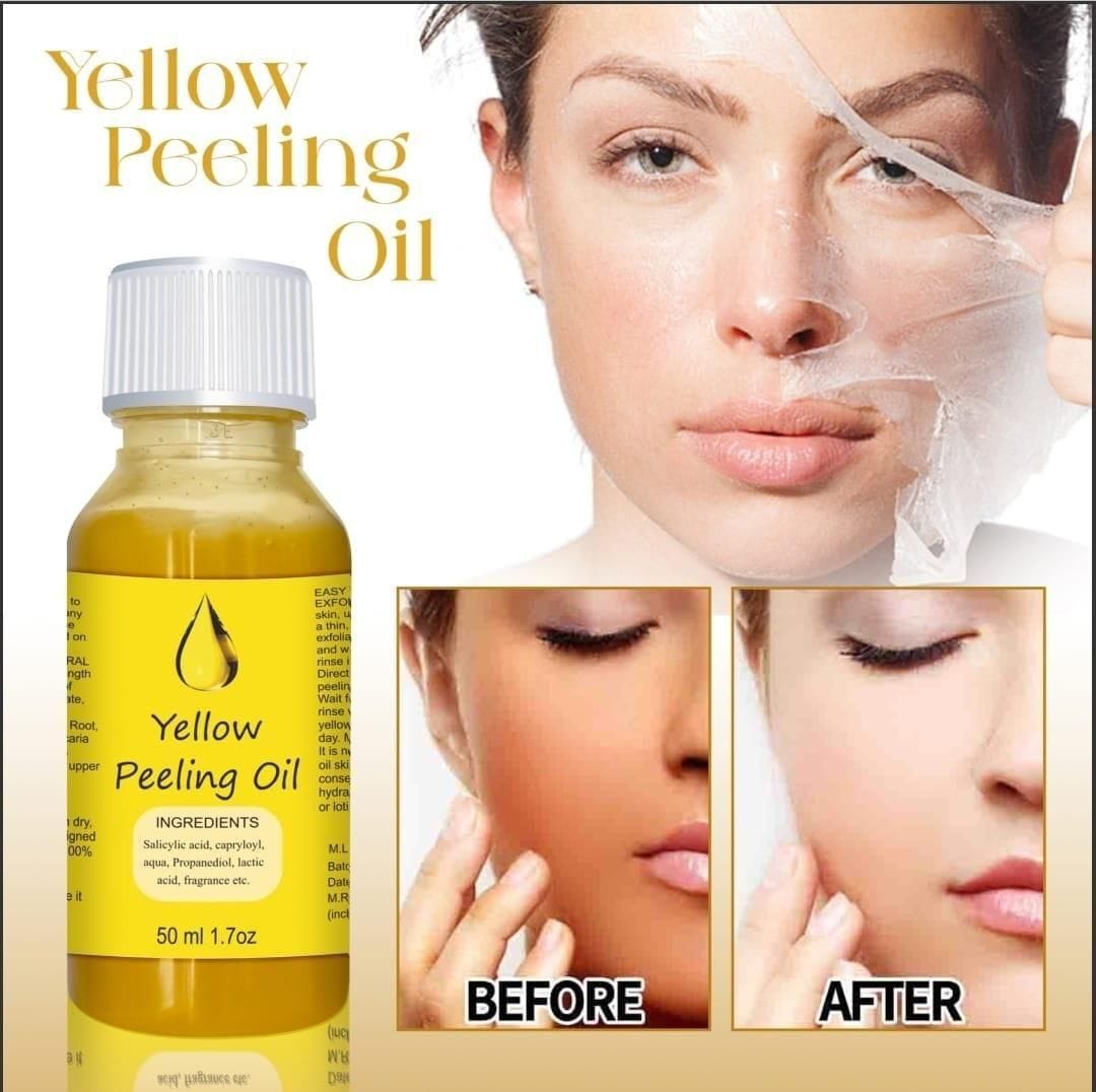 RadiateResplend™️ Peeling Oil for Skin (Pack of 2)