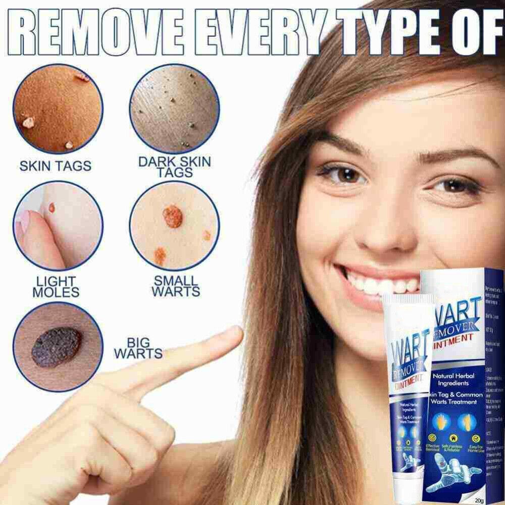 Wart Remover (Buy 1, Get 1 Free)